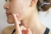 Top 5 Phòng khám da liễu tốt nhất Hà Tĩnh được nhiều người tìm đến