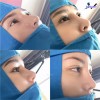 Top 3 Địa chỉ nâng mũi đẹp và an toàn nhất Tân An Long An đội ngũ bác sĩ chất lượng (2)
