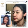 Top 5 Địa chỉ nâng mũi đẹp Pleiku Gia Lai và an toàn nhất vẻ đẹp bền vững (1)
