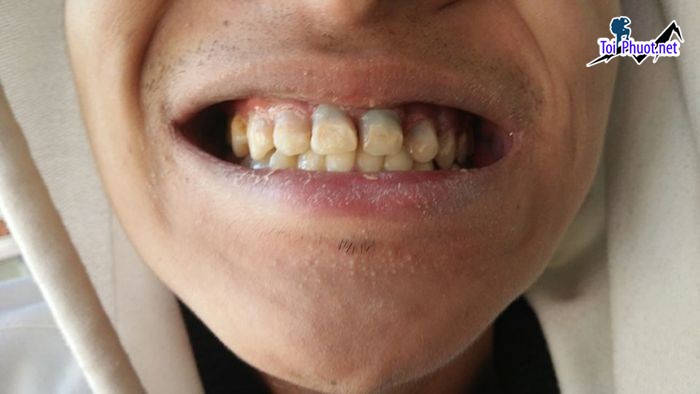 Top 10 Phòng khám nha khoa tốt nhất tại Lạng Sơn thiết bị hiện đại (1)