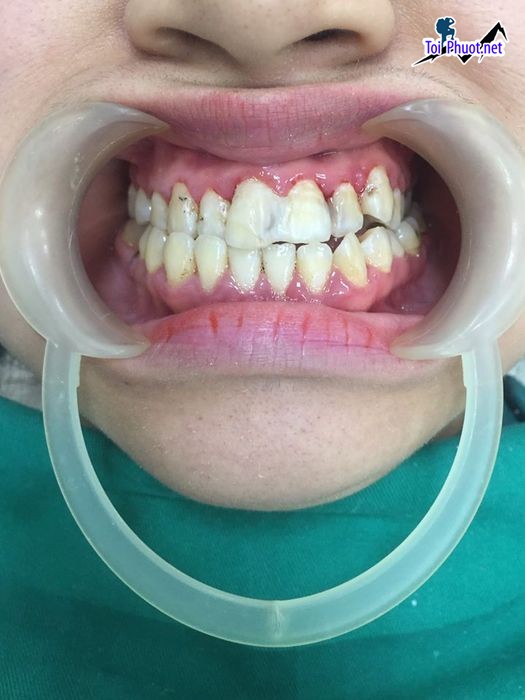 Top 10 Phòng khám nha khoa tốt nhất tại Lạng Sơn thiết bị hiện đại (2)