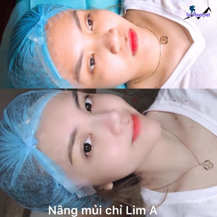 Top 10 Thẩm mỹ viện uy tín và nổi tiếng nhất Thừa Thiên – Huế dịch vụ hàng đầu (4)