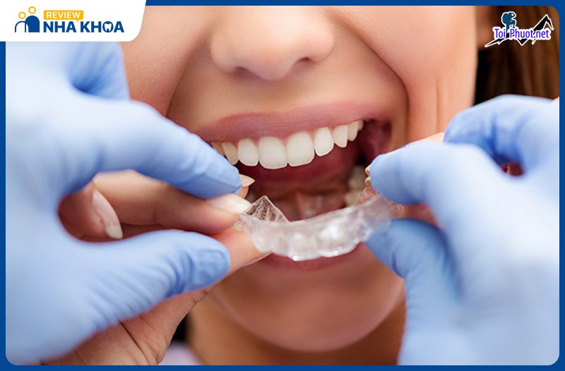 Top 11 Phòng khám nha khoa tốt nhất tại Lai Châu chăm sóc răng cho bạn (5)