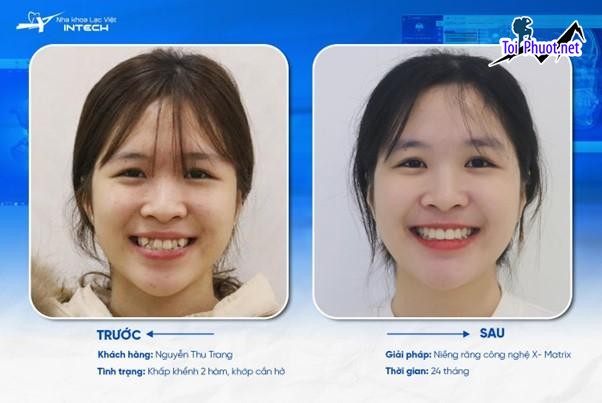Top 15 Phòng khám nha khoa tốt nhất tại Hà Nội trình độ chuyên môn cao (1)