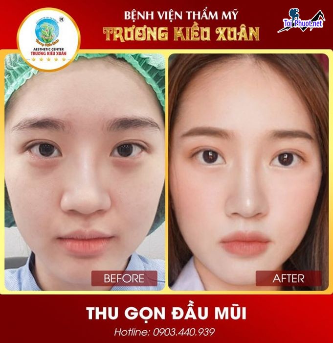 Top 3 Thẩm mỹ viện uy tín và nổi tiếng nhất Lai Châu điểm đến ưa thích của chị em (3)