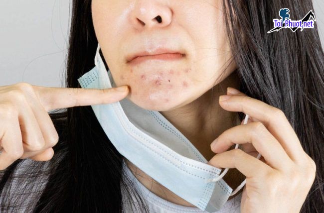 Top 7 Phòng khám da liễu tốt nhất Cần Thơ uy tín hàng đầu (3)