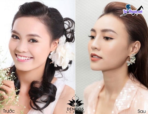 Top 10 Địa chỉ nâng mũi đẹp và an toàn nhất Bắc Giang công nghệ cao (4)