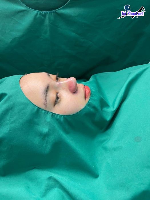 Top 12 Địa chỉ nâng mũi đẹp và an toàn nhất Thái Nguyên giá cả tốt nhất (5)