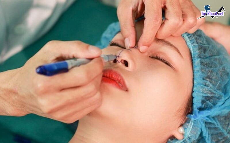 Top 12 Địa chỉ nâng mũi đẹp và an toàn nhất Tuyên Quang đảm bảo chất lượng dịch vụ (3)