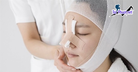 Top 3 Địa chỉ nâng mũi đẹp và an toàn nhất Trà Vinh được đánh giá cao (1)