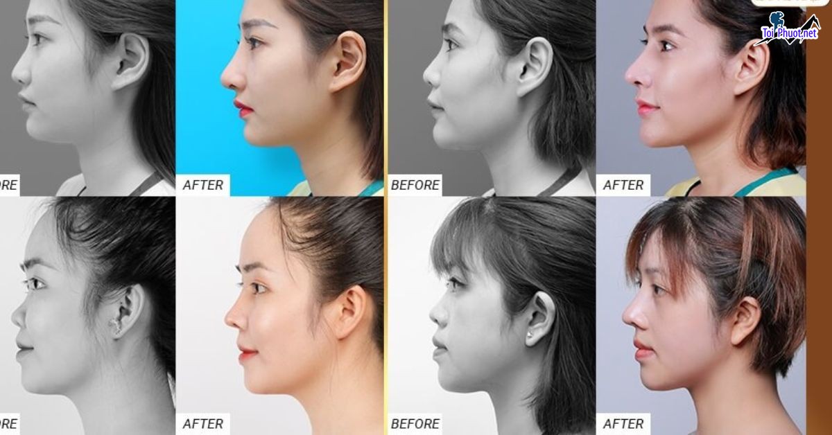 Top 6 Địa chỉ nâng mũi đẹp và an toàn nhất Thừa Thiên   Huế đáng tin cậy (3)