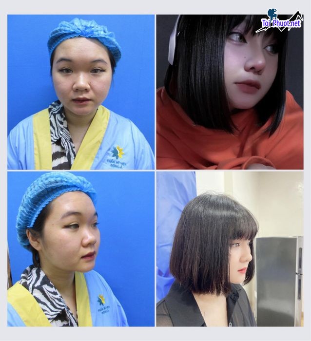 Top 8 Địa chỉ nâng mũi đẹp Hồ Chí Minh và an toàn nhất làm hài lòng nhất (3)