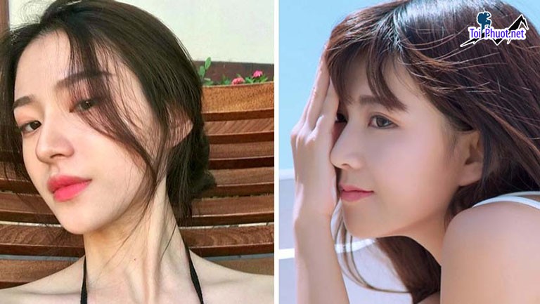 Top 9 Địa chỉ nâng mũi đẹp Đà Nẵng và an toàn nhất lâu dài (2)